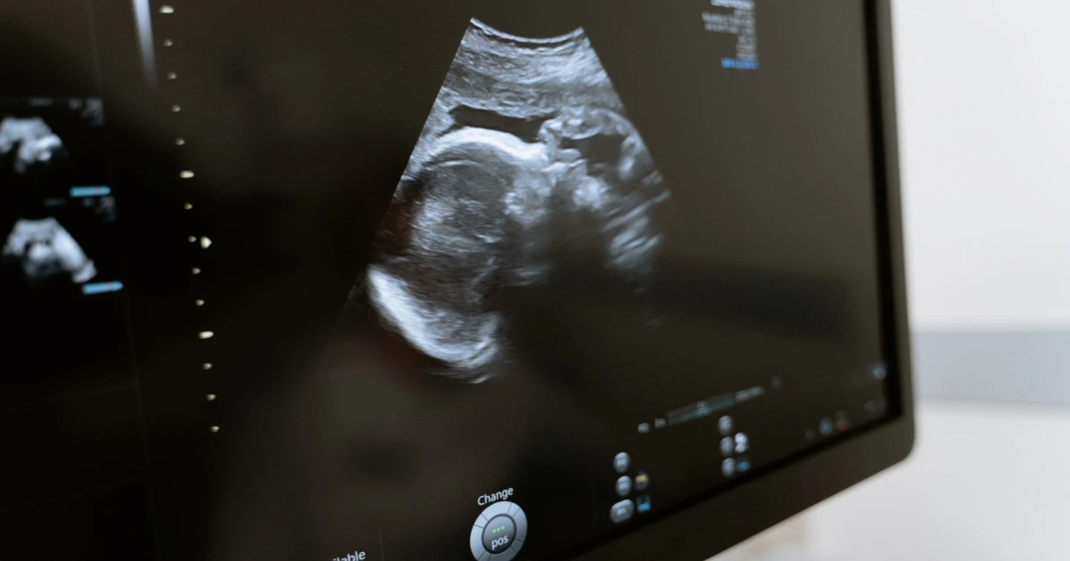 Monitor diagnostico che mostra un'ecografia clinica eseguita d'urgenza in reparto.